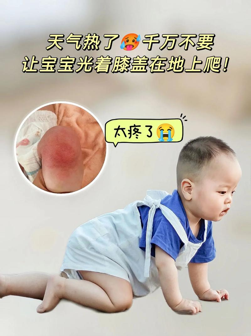 宝宝～腿趴开一点就不会疼